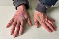 Bild från förundersökningen