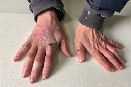 Bild från förundersökningen